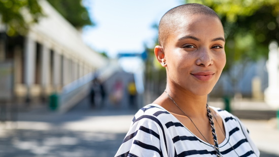 Young woman with bald head