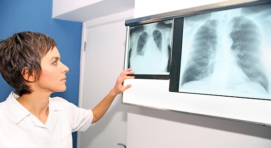 woman examining chest x-ray