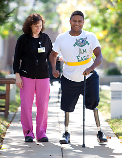 amputee is walking with staff