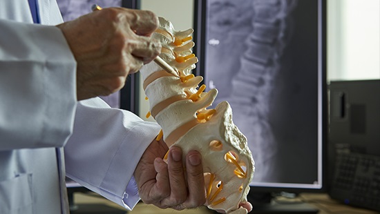 Doctor holding a spine model