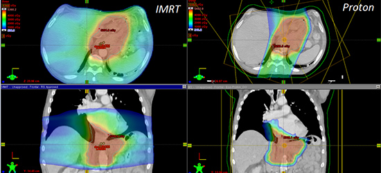 image of proton therapy scan