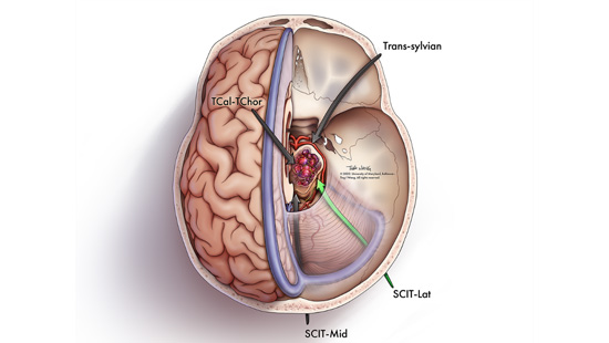 An illustration of the brain showing the various brain structures from above.