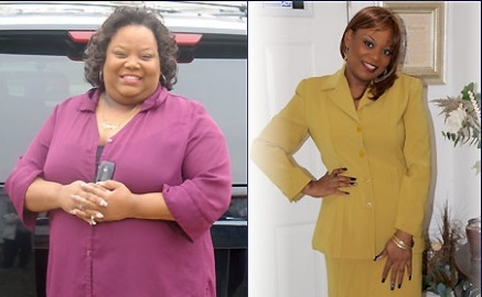 Vonda Bennett before and after bariatric surgery