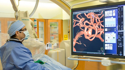 Interventional neuroradiologist performing a procedure