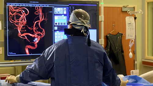 Doctor looking at scans of an aneurysm