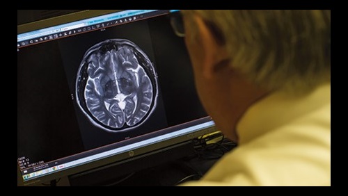 A doctor examines a brain scan