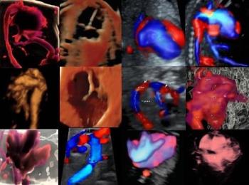 fetal heart photos