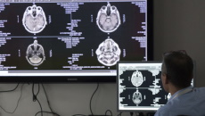 Man viewing scans of a brain tumor