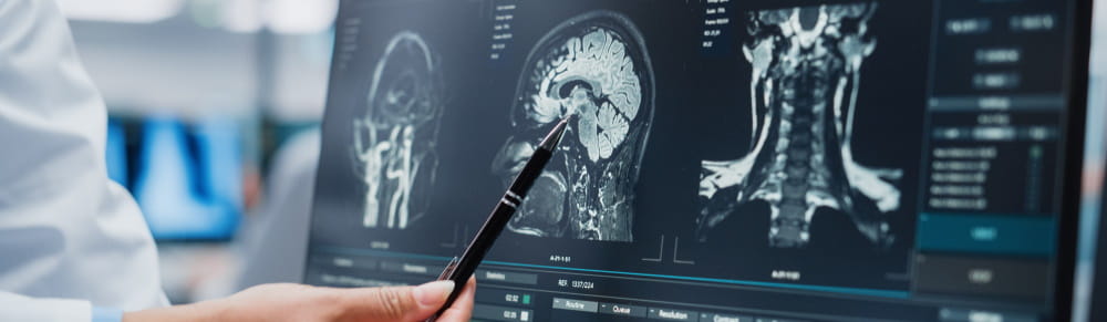 Doctor pointing to a brain scan