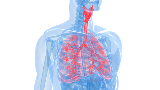 A graphic of an Xray of someone's chest w/ the lungs and throat turned red